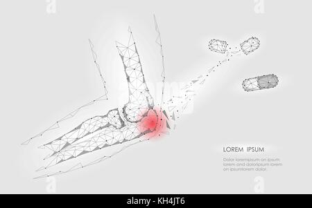 Capsula di farmaco cura il giunto a gomito malattia. rosso area dolore bassa poli geomentic medicina del futuro concetto di tecnologia. innovazione scienza della medicina. braccio lesioni ulna connessione poligonale illustrazione vettoriale Illustrazione Vettoriale