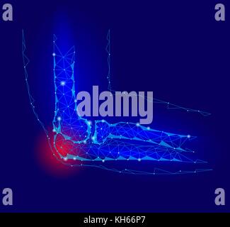 Gomito dolorosa malattia comune. rosso area dolore bassa poli geomentic medicina del futuro concetto di tecnologia. innovazione scienza della medicina. braccio lesioni ulna connessione poligonale illustrazione vettoriale Illustrazione Vettoriale