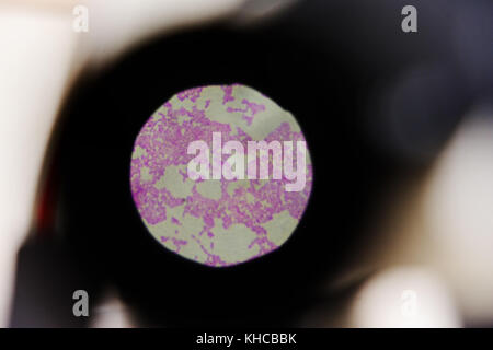 Una molecola di gonorrea attraverso un microscopio Foto Stock