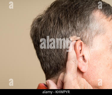 In prossimità di un piccolo moderno hearing aid dietro l'orecchio Foto Stock