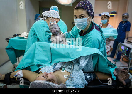 Sala operatoria medico lale kilich mostra il neonato alla madre Foto Stock