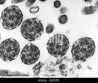 Area bronchiolare cilia sezioni trasversali 1 Foto Stock