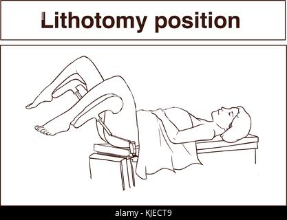Posizione di litotomia Illustrazione Vettoriale