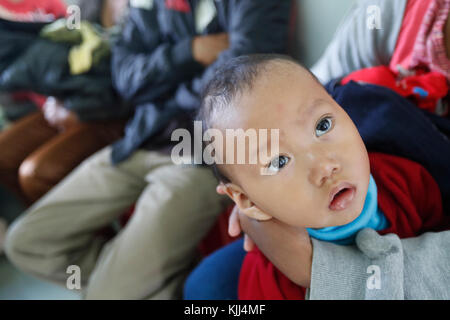 Free health clinic gestito dalle Suore Francescane Missionarie di Maria. La minoranza etnica bambino. Dalat. Il Vietnam. Foto Stock