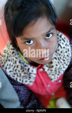 Free health clinic gestito dalle Suore Francescane Missionarie di Maria. La minoranza etnica bambino. Dalat. Il Vietnam. Foto Stock