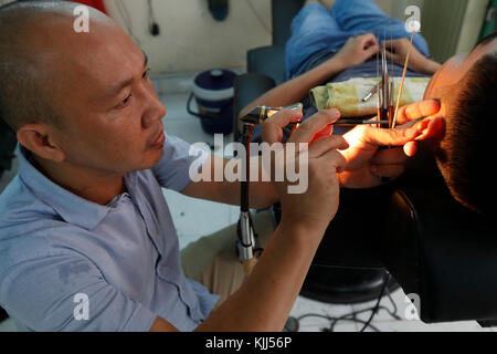 Il vietnamita barbiere. Pulizia dell'orecchio. Ho Chi Minh City. Il Vietnam. Foto Stock