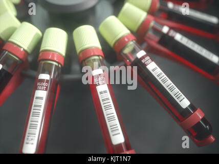 Attrezzature da laboratorio per la centrifugazione del sangue. Concetto di immagine di un esame del sangue. Foto Stock