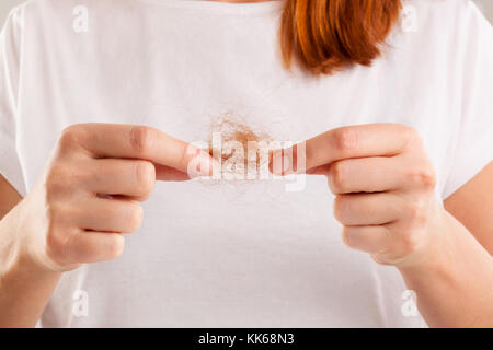 Donna perdita di capelli. bella redhair con i capelli del ciuffo di peli isolati. Foto Stock