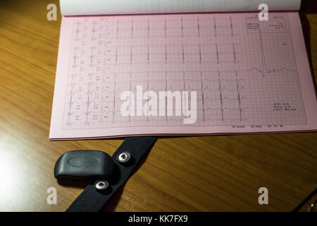 Un electrokardiogram foglio di stampa su un ufficio medici close up Foto Stock