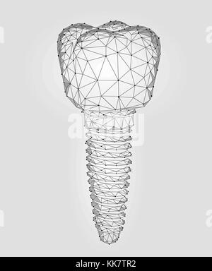 Dente molare impianto dentale 3d bassa poli modello geometrico. odontoiatria l'innovazione futura tecnologia titan filo di metallo. medico scienza sani astratto bianco grigio punto poligonale della linea illustrazione vettoriale Illustrazione Vettoriale