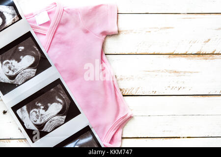 Rosa e azzurro baby romper e ultrasuoni in bianco sullo sfondo di legno.copyspace Foto Stock