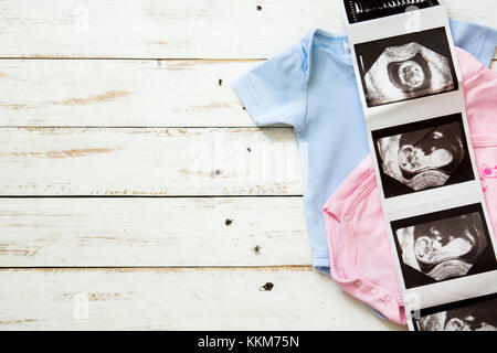 Rosa e azzurro baby romper e ultrasuoni in bianco sullo sfondo di legno.copyspace Foto Stock