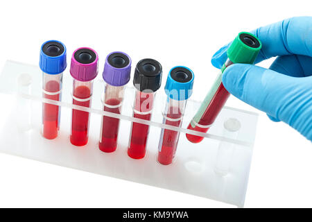 Rack di sangue di prova sul supporto bianco su bianco bacground Foto Stock