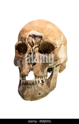 Cranio umano isolato. Foto Stock