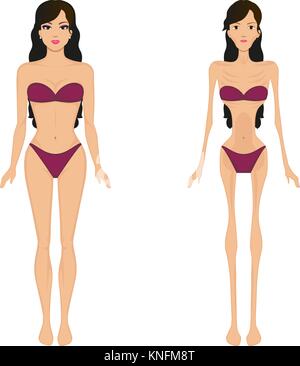 Illustrazione Vettoriale femmina di anoressia. Le donne la bulimia Illustrazione Vettoriale