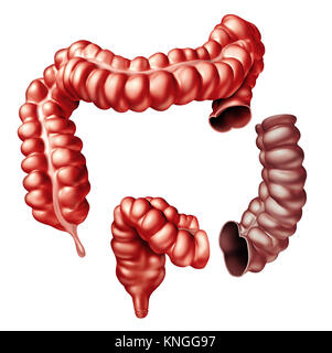 Colectomia chirurgia del colon procedura medica nella rimozione di una porzione dell'intestino crasso come 3D'intestino. Foto Stock