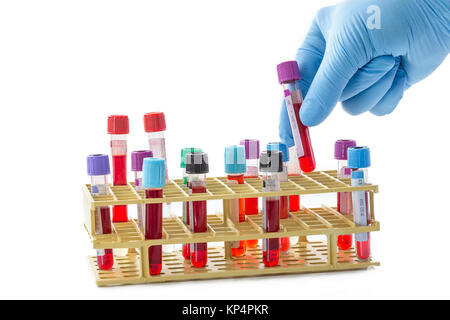 Laboratorio di analisi Foto Stock