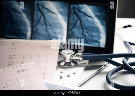 Il trattamento di malattie cardiovascolari ( qui angiogramma coronarico stenosato arteria). Foto Stock