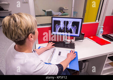 Un medico utilizza un osso Densitometro per misurare la densità ottica del collo del femore del paziente di sesso femminile per la diagnosi di osteoporosi, Angouleme hospit Foto Stock