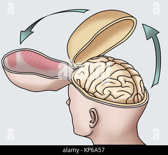 Autopsia illustrazione Foto Stock