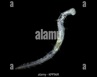 Campo scuro Micrografia di un minuscolo Aeolosoma worm, circa 1 mm di lunghezza Foto Stock