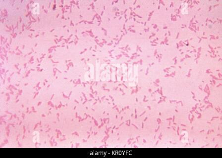 Tale micrografia mostra il Bacteroides fragilis ss, 1972. fragilis batteri coltivati nel sangue terreno di agar per 48 ore. Gram-negativi B. fragilis, sebbene commensale batteri che normalmente vive nel tratto gastrointestinale umano, può diventare patogeno in circostanze che comportano interruzioni del normale mucosa intestinale quali ad esempio trauma o chirurgia. Immagine cortesia CDC/Dott. V.R. Dowell, Jr. Foto Stock