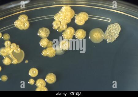 Si tratta di un tripticasi soia piastra di agar coltura di Enterobacter sakazakii mostra stropicciata colonie dopo tre giorni a 25 <SUP>{gradi}</sup> C. E. sakazakii, gram-negativi, a forma di asta, batterio dalla famiglia enterobatteriacee, 1978. E. sakazakii è associata con una malattia rara, ma spesso fatale forma di meningite neonatale con un tasso di mortalità del 40 al 80 per cento. Immagine cortesia CDC/Dott. J. J. agricoltore. Foto Stock