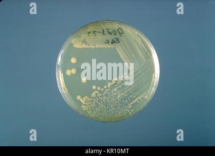 Si tratta di un tripticasi soia piastra di agar coltura di Enterobacter sakazakii dopo tre giorni di crescita a 25 <SUP>{gradi}</sup> C. Enterobacter sakazakii, gram-negativi, a forma di asta, batterio dalla famiglia enterobatteriacee, 1978. E. sakazakii è associata con una malattia rara, ma spesso fatale forma di meningite neonatale con un tasso di mortalità del 40 al 80 per cento. Immagine cortesia CDC/Dott. J. J. agricoltore. Foto Stock