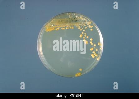 Si tratta di un tripticasi soia piastra di agar coltura di Enterobacter sakazakii dopo tre giorni di crescita a 25 <SUP>{gradi}</sup> C. Enterobacter sakazakii, gram-negativi, a forma di asta, batterio dalla famiglia enterobatteriacee, 1978. E. sakazakii è associata con una malattia rara, ma spesso fatale forma di meningite neonatale con un tasso di mortalità del 40 al 80 per cento. Immagine cortesia CDC/Dott. J. J. agricoltore. Foto Stock