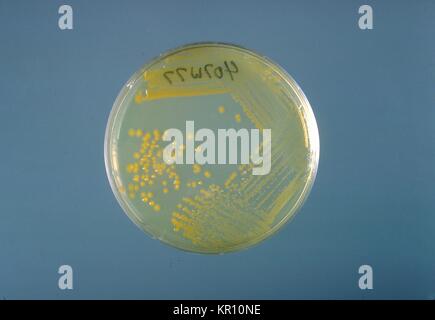 Si tratta di un tripticasi soia piastra di agar coltura di Enterobacter sakazakii dopo tre giorni di crescita a 25{gradi} C. Enterobacter sakazakii, gram-negativi, a forma di asta, batterio dalla famiglia enterobatteriacee, 1978. E. sakazakii è associata con una malattia rara, ma spesso fatale forma di meningite neonatale con un tasso di mortalità del 40 al 80 per cento. Immagine cortesia CDC/Dott. J. J. agricoltore. Foto Stock