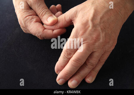 Senior uomo con dolori pollice Foto Stock