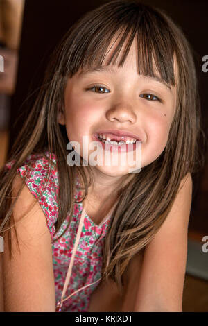 Bambina di cinque anni perde i suoi due denti frontali Foto Stock