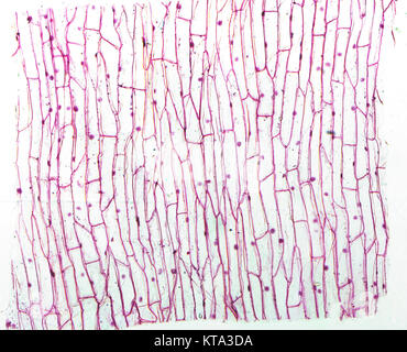 Onion micrografia epidermus Foto Stock