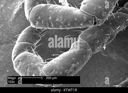 Questo scanning electron microfotografia (SEM) raffigura una vista dorsale della gamba appendici di un american dog tick, Dermacentor coenobita, ingrandita 102X. Le zecche sono della classe Arachnida, come sono i ragni ed acari, 2002. D. coenobita è un vettore noto di Rocky Mountain Spotted febbre causata dal batterio Rickettsia rickettsii . Immagine cortesia CDC. Foto Stock