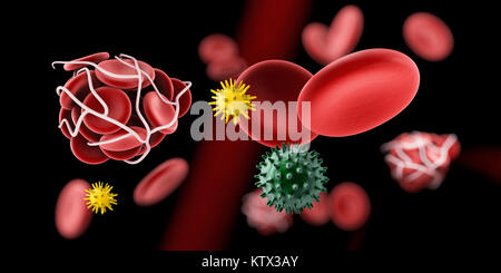 Di coagulo di sangue e trombosi medical 3d illustrazione del concetto. Foto Stock