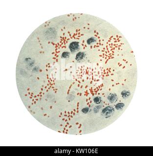 Questa illustrazione mostra una microfotografia di Yersinia (Pasteurella) pestis, talvolta indicato come Bacillus pestis, batteri. Yersinia pestis peste provoca negli animali e negli esseri umani. La gente di solito ottenere piaga di essere morso da un roditore flea che sta portando il batterio della peste, o mediante la manipolazione di un animale infetto. Immagine cortesia CDC. 1975. Foto Stock