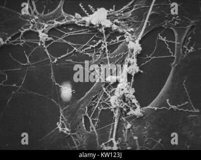 Micrografia elettronica di Treponema pallidum su colture di cotone-coda di coniglio di cellule di epitelio (SF1Ep). Treponema pallidum è l'agente eziologico della sifilide. Negli Stati Uniti, oltre 35, 600 casi di sifilide sono stati riportati da funzionari della sanità nel 1999. Immagine cortesia CDC/Dott. David Cox, 1980. Foto Stock