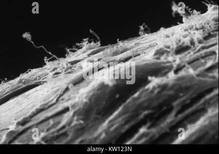 Micrografia elettronica di Treponema pallidum su colture di cotone-coda di coniglio di cellule di epitelio (SF1Ep). Treponema pallidum è l'agente eziologico della sifilide. Negli Stati Uniti, oltre 35, 600 casi di sifilide sono stati riportati da funzionari della sanità nel 1999. Immagine cortesia CDC/Dott. David Cox, 1980. Foto Stock