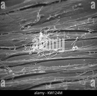 Micrografia elettronica di Treponema pallidum su colture di cotone-coda di coniglio di cellule di epitelio (SF1Ep). Treponema pallidum è l'agente eziologico della sifilide. Negli Stati Uniti, oltre 35, 600 casi di sifilide sono stati riportati da funzionari della sanità nel 1999. Immagine cortesia CDC/Dott. David Cox, 1980. Foto Stock