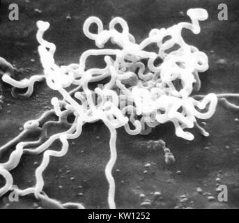 Micrografia elettronica di Treponema pallidum su colture di cotone-coda di coniglio di cellule di epitelio (SF1Ep). Treponema pallidum è l'agente eziologico della sifilide. Negli Stati Uniti, oltre 35, 600 casi di sifilide sono stati riportati da funzionari della sanità nel 1999. Immagine cortesia CDC/Dott. David Cox, 1980. Foto Stock