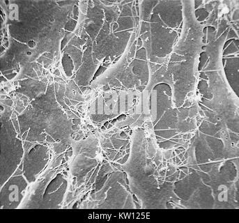 Micrografia elettronica di Treponema pallidum su colture di cotone-coda di coniglio di cellule di epitelio (SF1Ep). Treponema pallidum è l'agente eziologico della sifilide. Negli Stati Uniti, oltre 35, 600 casi di sifilide sono stati riportati da funzionari della sanità nel 1999. Immagine cortesia CDC/Dott. David Cox, 1980. Foto Stock