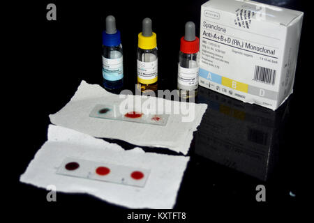 Campione di sangue sulla diapositiva per osservare il gruppo sanguigno usando sangue Kit gruppo Foto Stock
