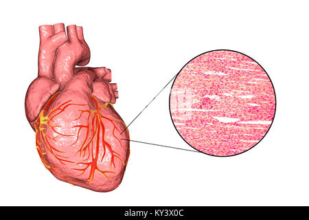 Computer illustrazione di un cuore umano e la micrografia luce del muscolo cardiaco. Il muscolo del cuore è composto da a forma di fuso cellule raggruppate in fasci irregolari. I confini tra le singole celle sono debolmente visibile qui. Ogni cella contiene un nucleo, visibile come un tinto scuro spot. Il muscolo cardiaco è un settore specializzato in tessuto muscolare che può contrarsi regolarmente e in modo continuo senza stancarsi. Foto Stock