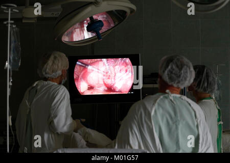 Città di Gomel in Bielorussia,.31 maggio 2017 Gomel ospedale medico.i medici in sala operatoria fare laparoscopia.Il funzionamento degli organi interni dell'uomo.Professio Foto Stock