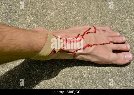 Maschio ferito al piede con sangue reale su un sfondo di calcestruzzo, Townsville, Queensland, Australia Foto Stock