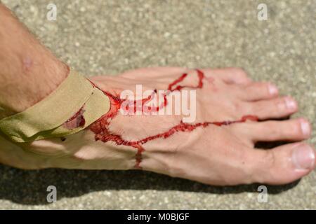 Maschio ferito al piede con sangue reale su un sfondo di calcestruzzo, Townsville, Queensland, Australia Foto Stock