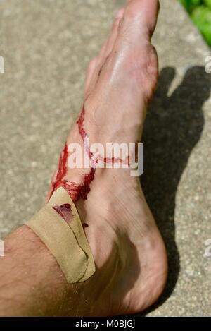 Maschio ferito al piede con sangue reale su un sfondo di calcestruzzo, Townsville, Queensland, Australia Foto Stock