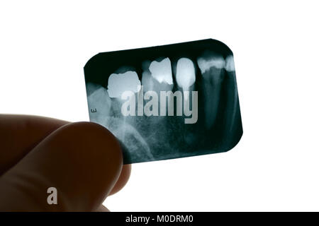 Apparecchiature odontoiatriche a raggi X di essere esaminato da un dentista Foto Stock