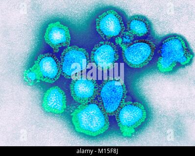 H3N2 virus influenzali di particelle colorate, microscopio elettronico a trasmissione (TEM). Ogni virus consiste di un nucleocapside (rivestimento di proteina) che circonda un nucleo di RNA (acido ribonucleico) materiale genetico. Che circonda il nucleocapside è un lipide busta che contiene i picchi della glicoproteina di emoagglutinina (H) e neuraminidasi (N). Questi virus sono stati parte di Hong Kong pandemia di influenza del 1968-1969 che ha ucciso circa un milione in tutto il mondo. H3N2 virus sono in grado di infettare gli uccelli e i mammiferi così come gli esseri umani. Foto Stock