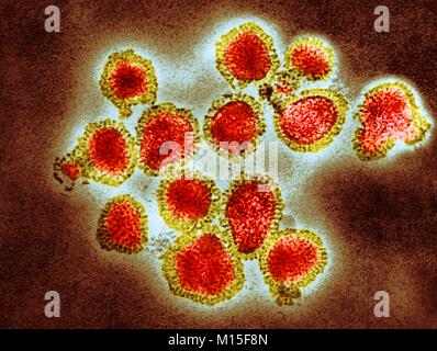 H3N2 virus influenzali di particelle colorate, microscopio elettronico a trasmissione (TEM). Ogni virus consiste di un nucleocapside (rivestimento di proteina) che circonda un nucleo di RNA (acido ribonucleico) materiale genetico. Che circonda il nucleocapside è un lipide busta che contiene i picchi della glicoproteina di emoagglutinina (H) e neuraminidasi (N). Questi virus sono stati parte di Hong Kong pandemia di influenza del 1968-1969 che ha ucciso circa un milione in tutto il mondo. H3N2 virus sono in grado di infettare gli uccelli e i mammiferi così come gli esseri umani. Foto Stock